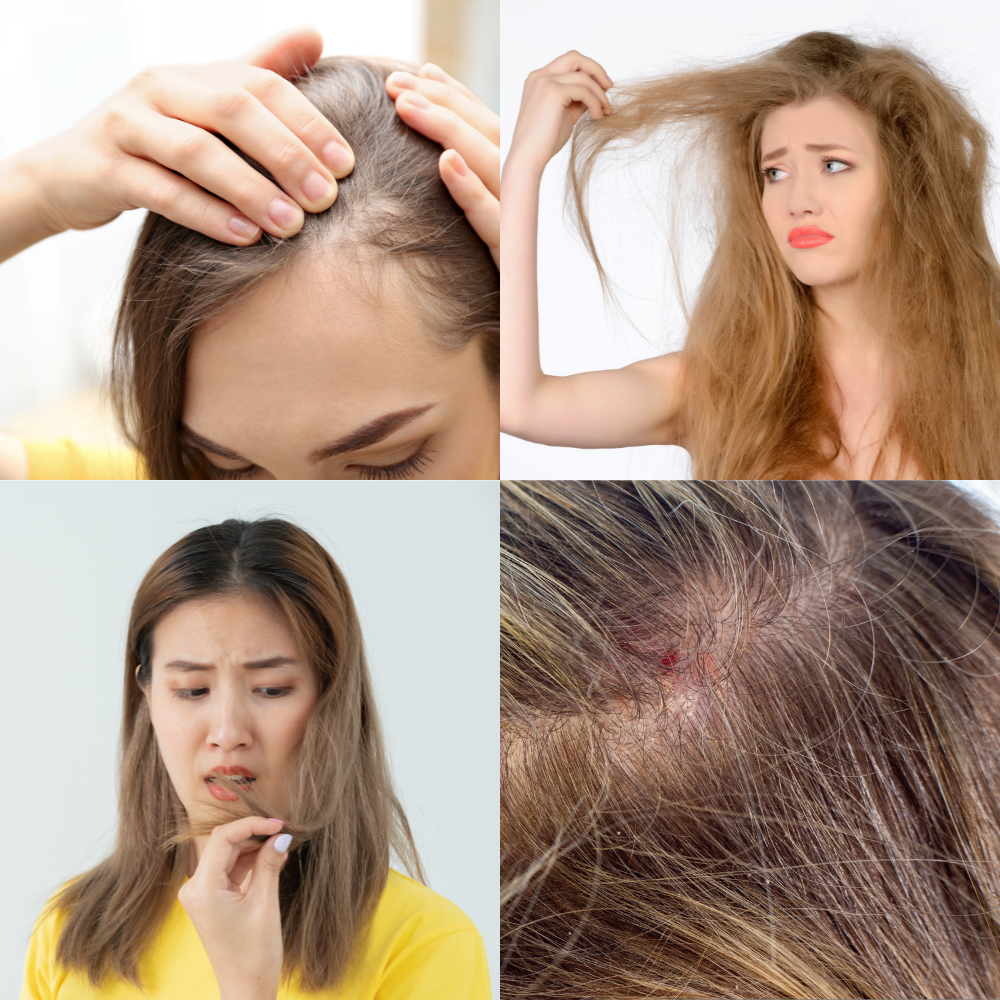 Hair problems PP.png__PID:207d0f35-cd15-4289-b855-ee481dd2362d